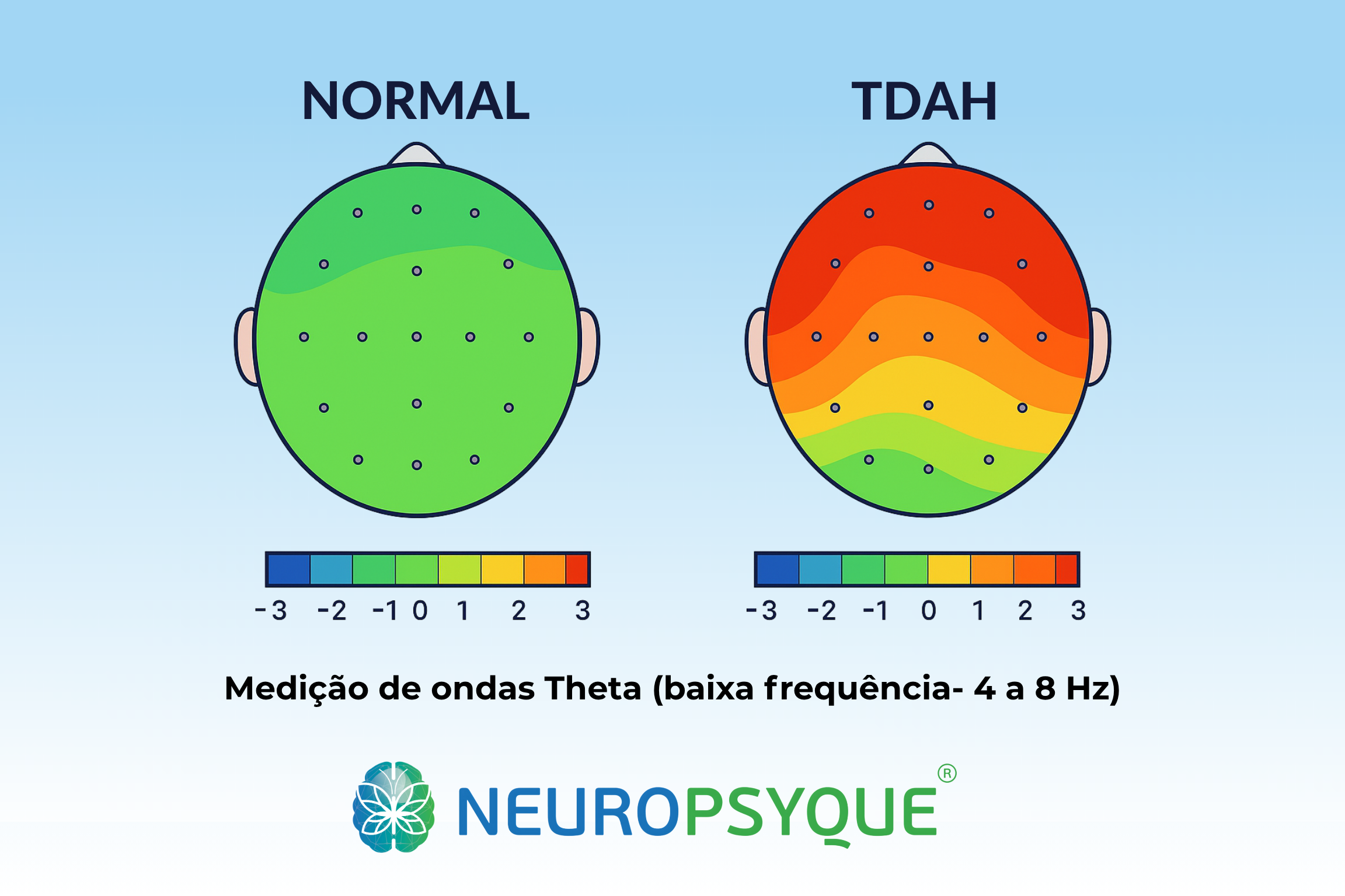 Mapa cerebral qEEG colorido