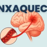 Enxaqueca: O Guia Completo (2025)